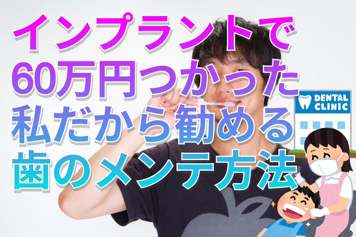 インプラントで60万円つかった私だから勧める歯のメンテナンス方法